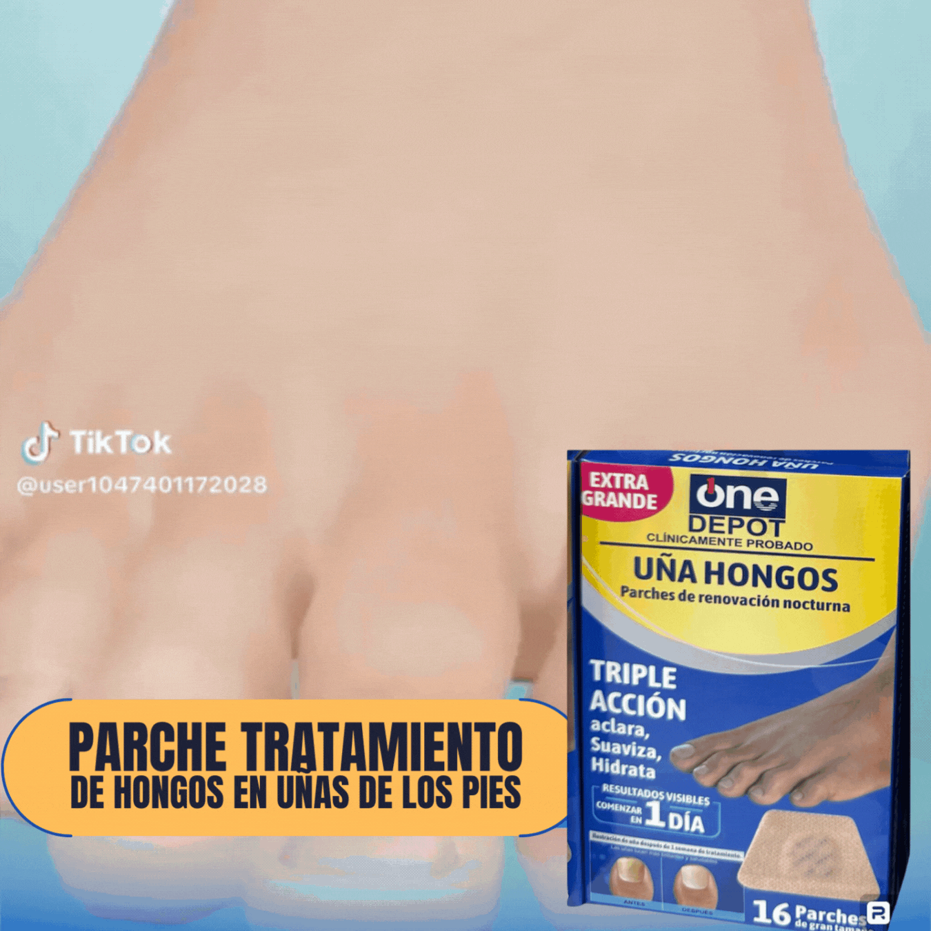 (Azul) Parche Anti Hongo Uña - Original